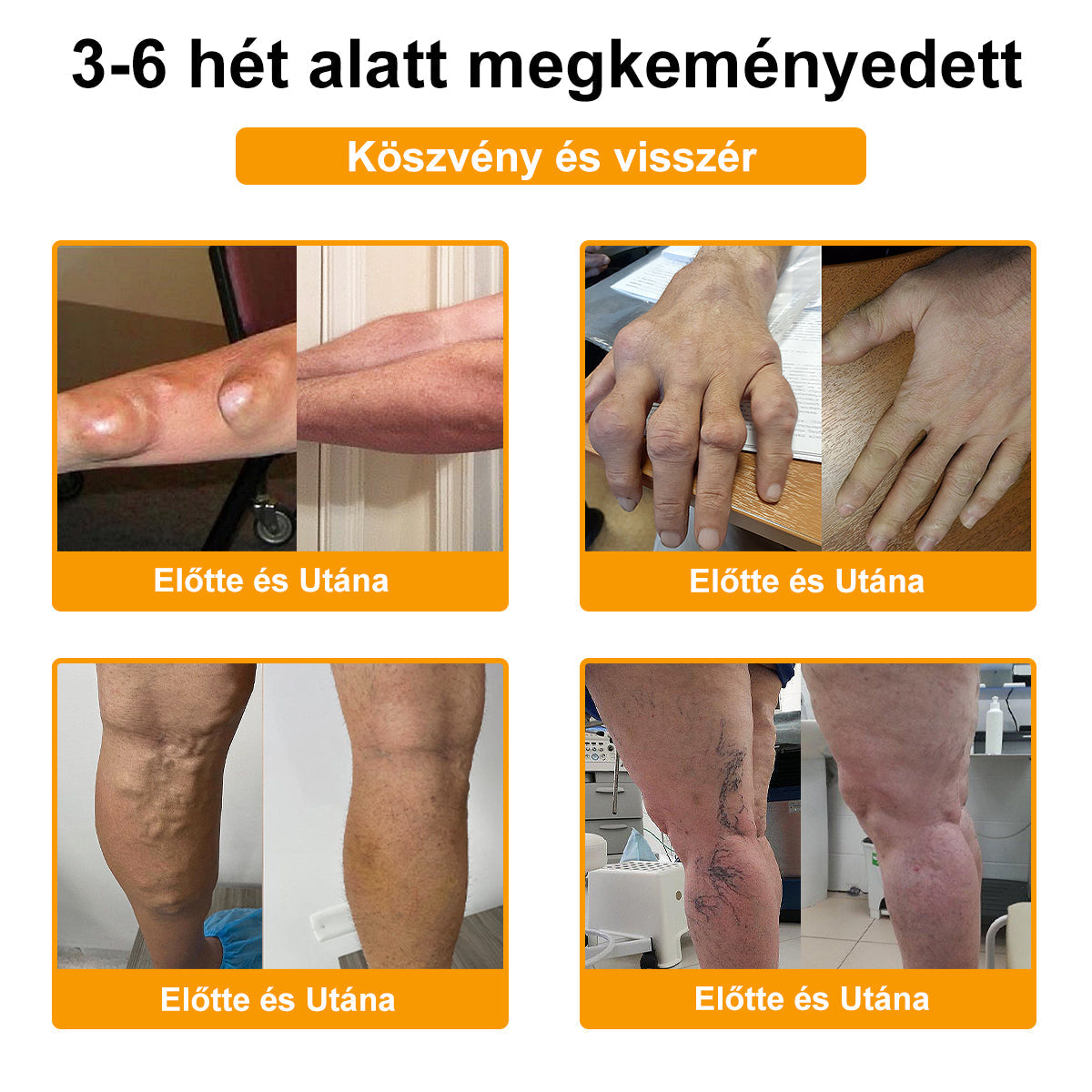 🎁 Már csak 5 doboz maradt! További 50%-os kedvezményt kínálunk! Szerezzétek vissza az alakotokat és egészségeteket. Most veszítsetek, és nem lesz több lehetőség jövő évig.