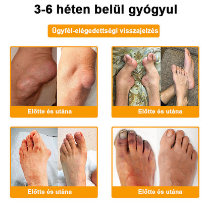 🎁 Már csak 5 doboz maradt! További 50%-os kedvezményt kínálunk! Szerezzétek vissza az alakotokat és egészségeteket. Most veszítsetek, és nem lesz több lehetőség jövő évig.